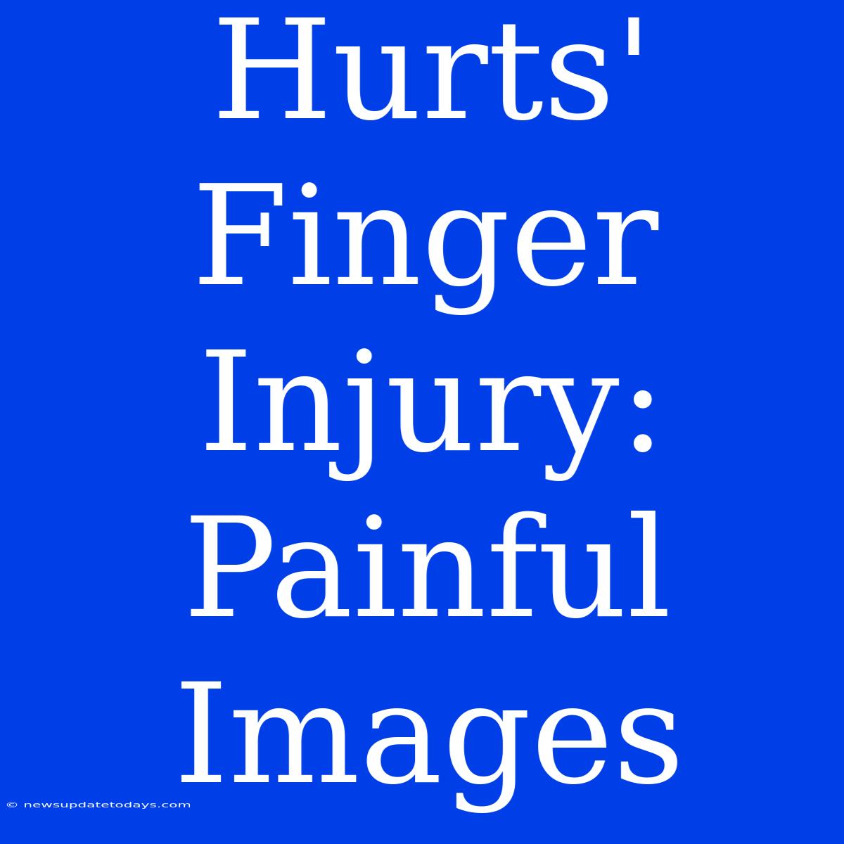 Hurts' Finger Injury: Painful Images