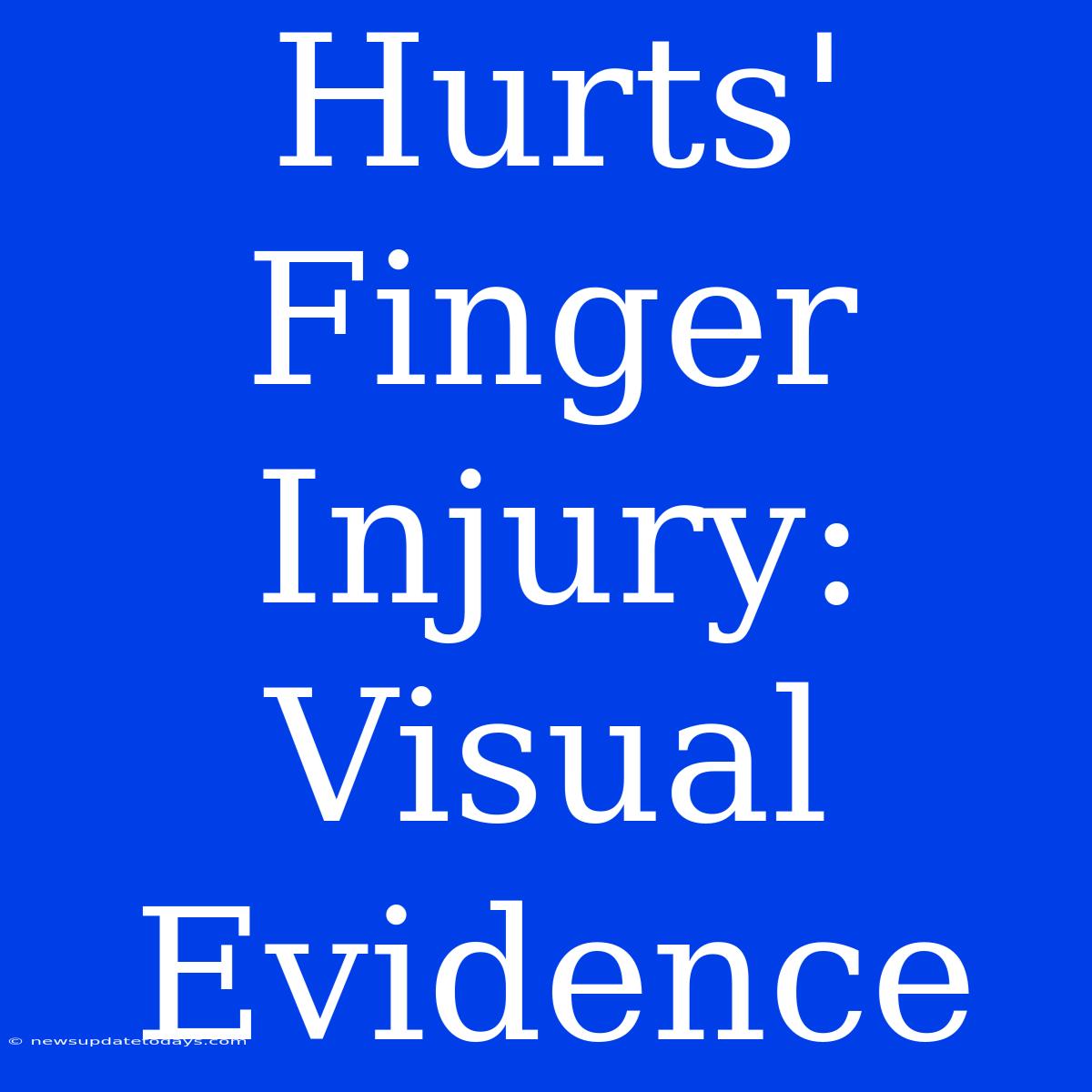 Hurts' Finger Injury: Visual Evidence