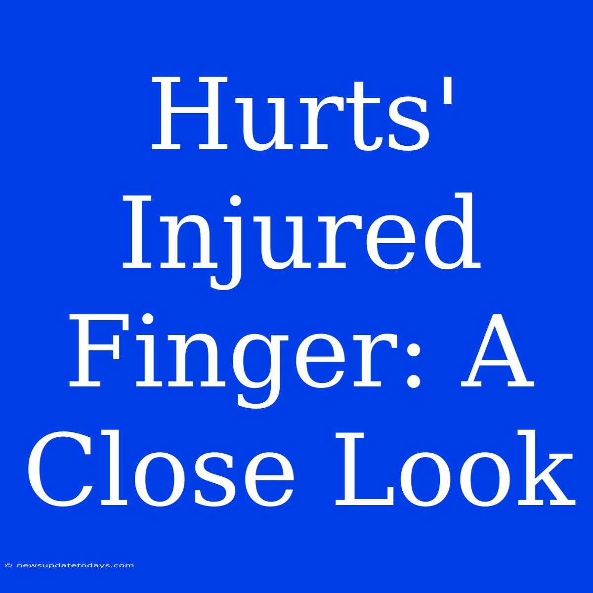 Hurts' Injured Finger: A Close Look