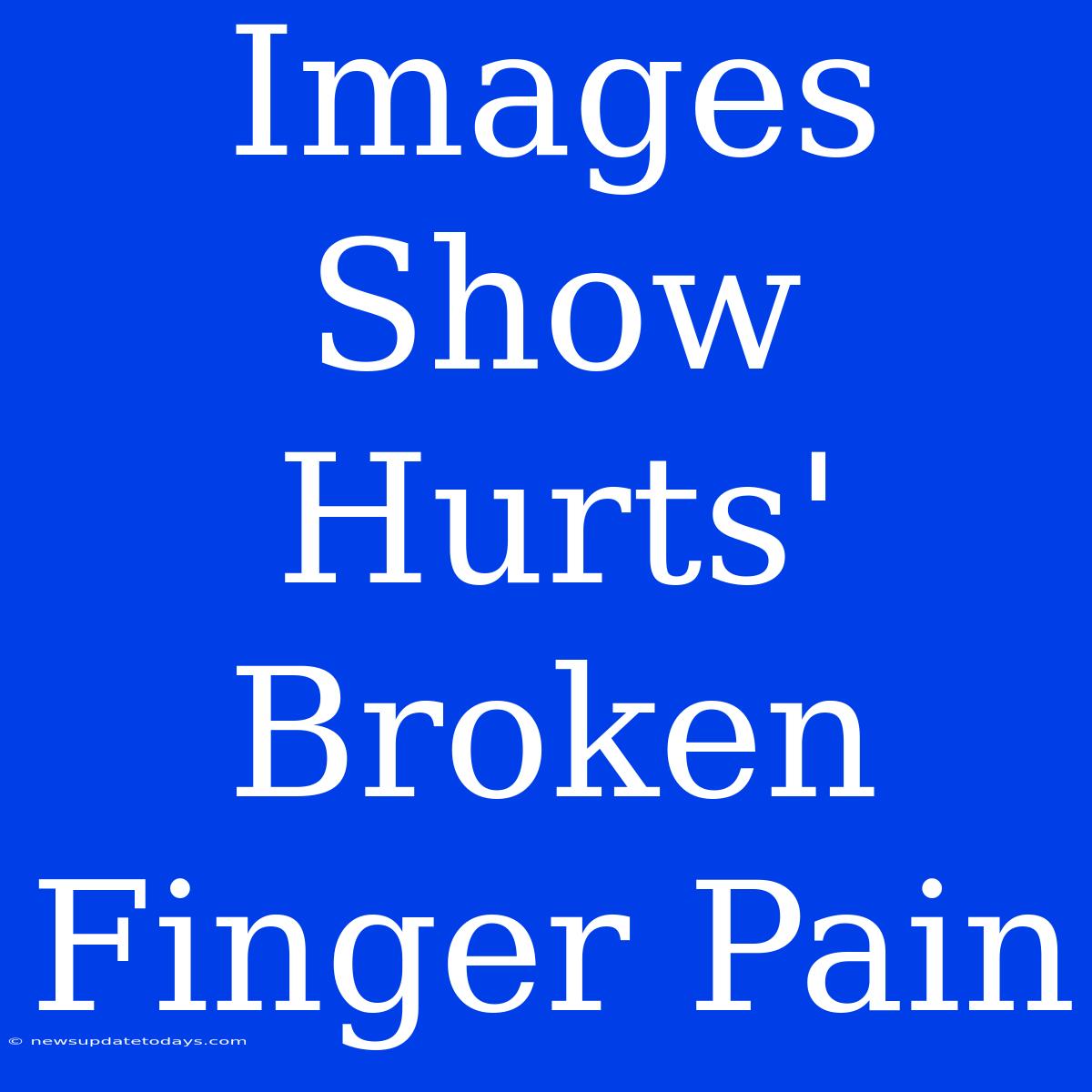 Images Show Hurts' Broken Finger Pain